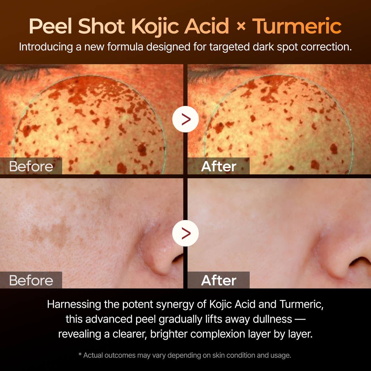 Peel Shot Kojic Acid Turmeric Serum Dr.Melaxin