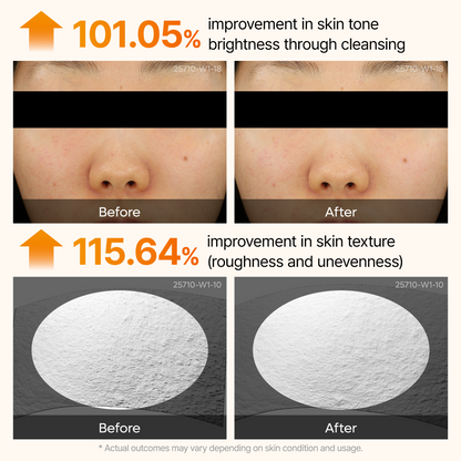 Peel Shot Kojic Acid Turmeric Serum Dr.Melaxin